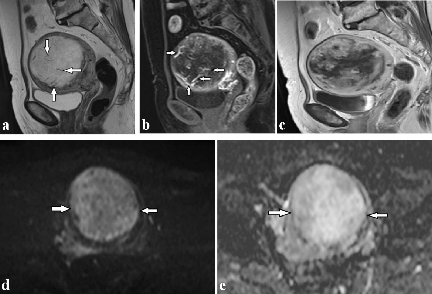 Journal Of Clinical Gynecology And Obstetrics Journal Of Clinical Gynecology And Obstetrics
