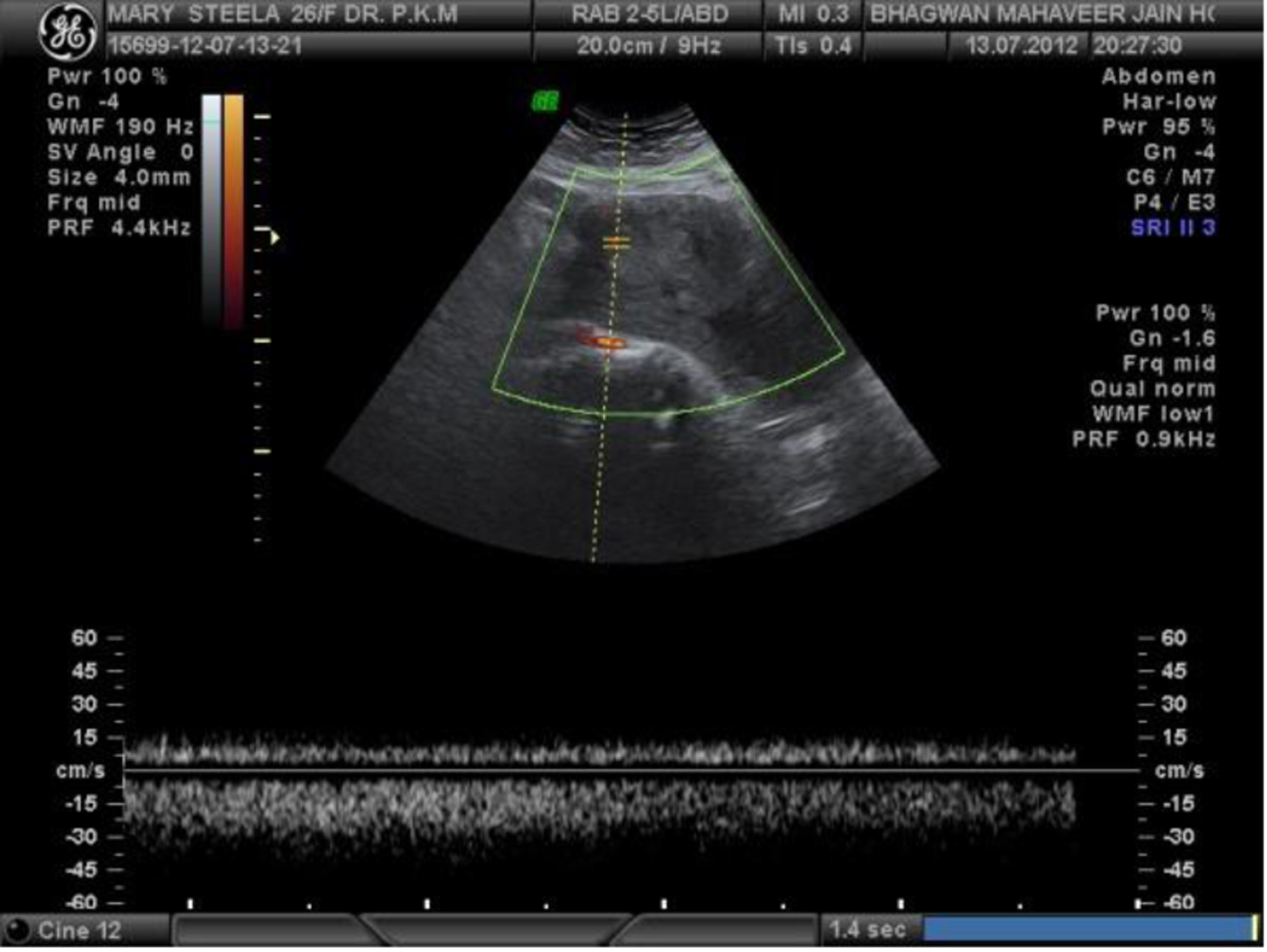 Figure 3. 