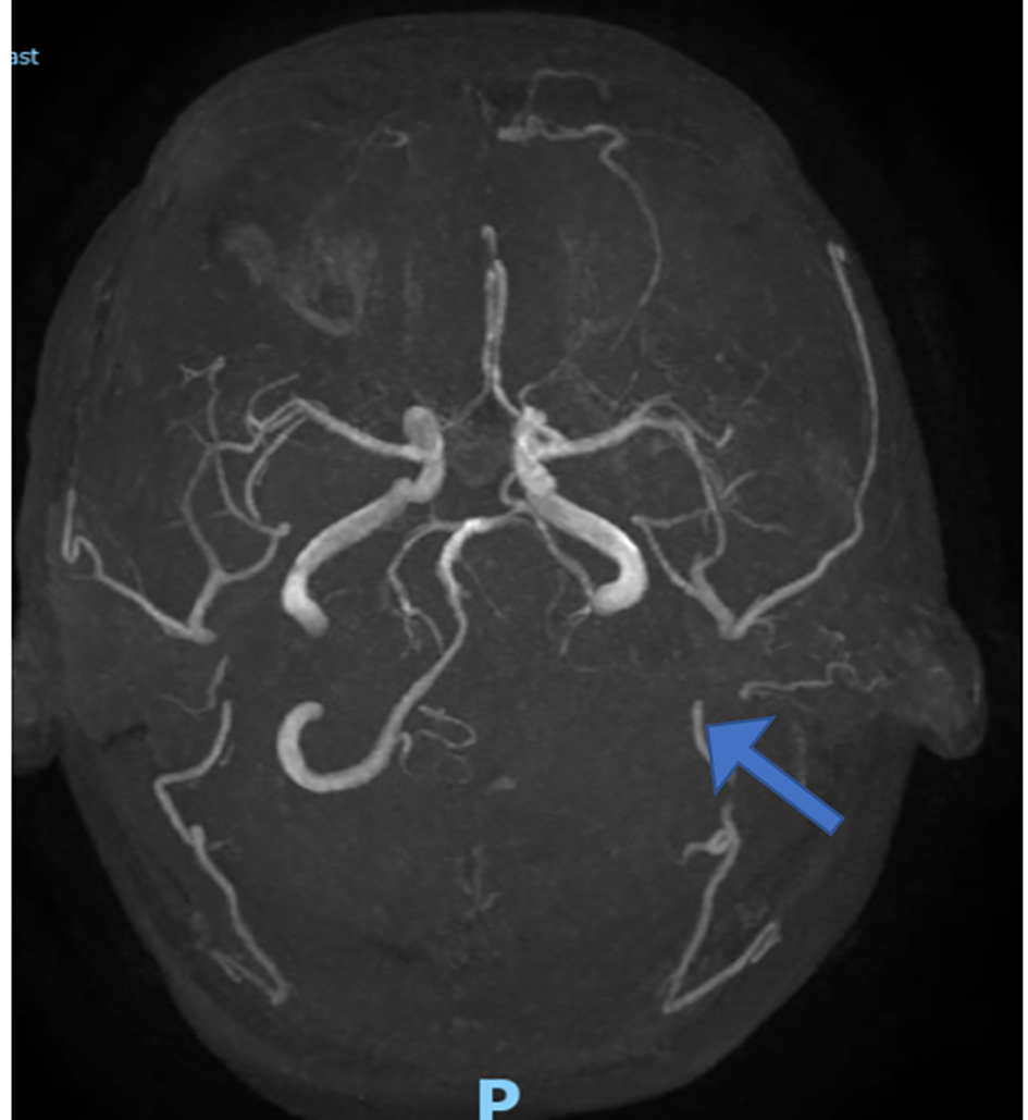 Figure 3. 