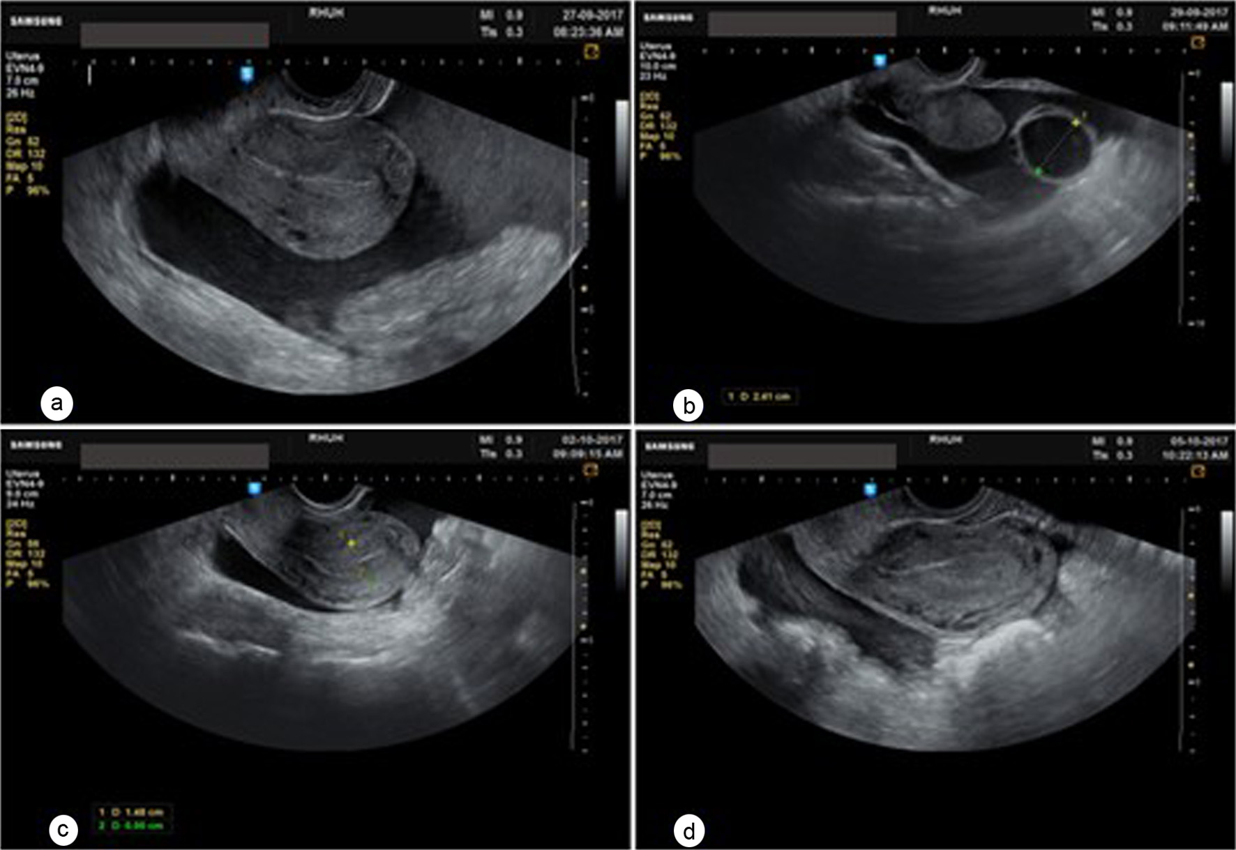 Figure 3. 